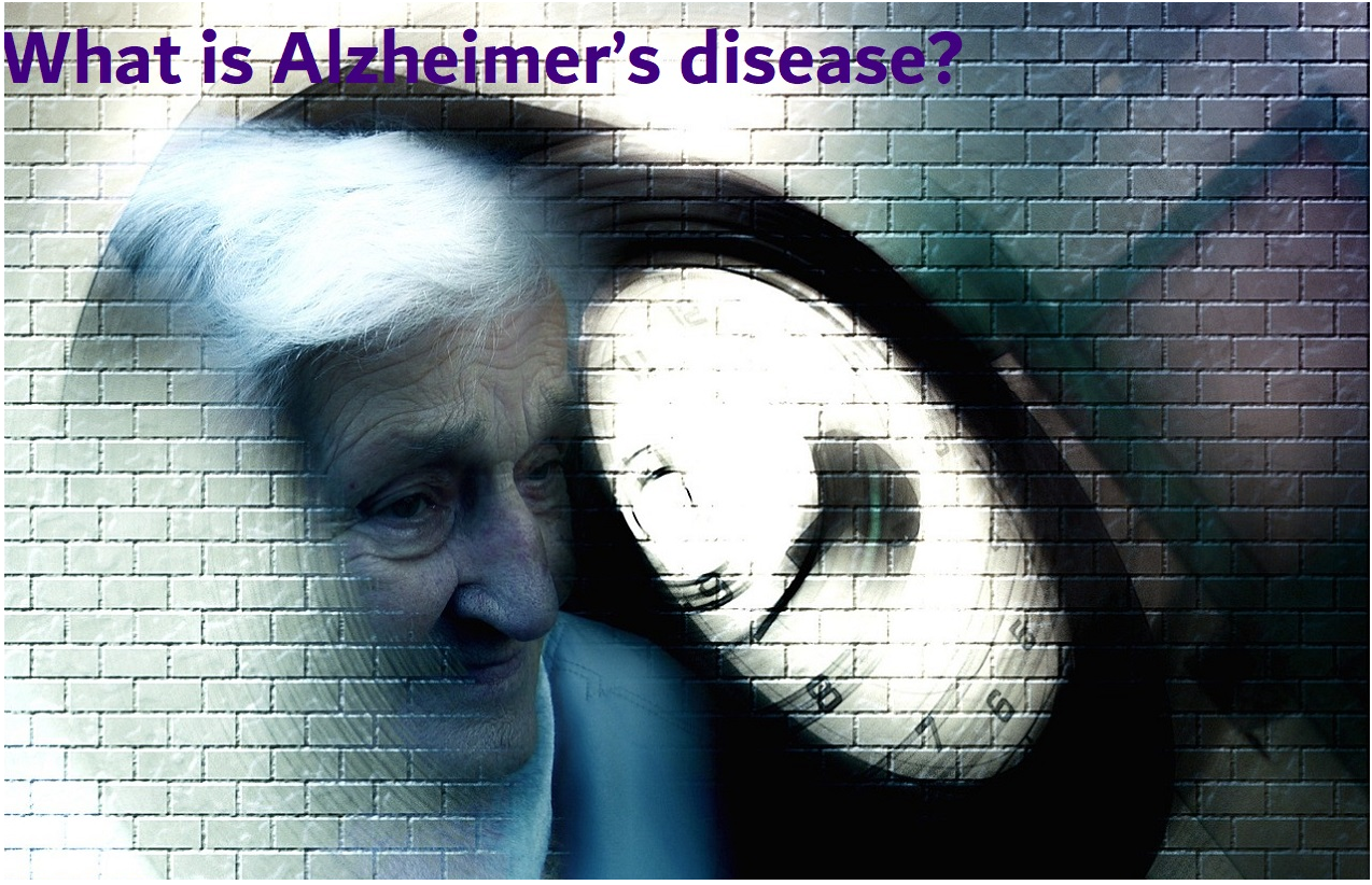 What is Alzheimer’s disease?